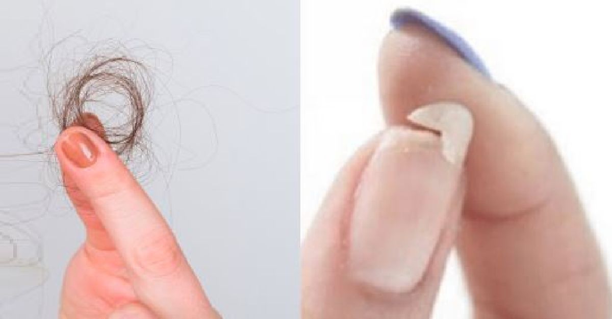 Voici ce que vous devez savoir si vous avez troubles du sommeil, ongles fragiles et perte de cheveux!